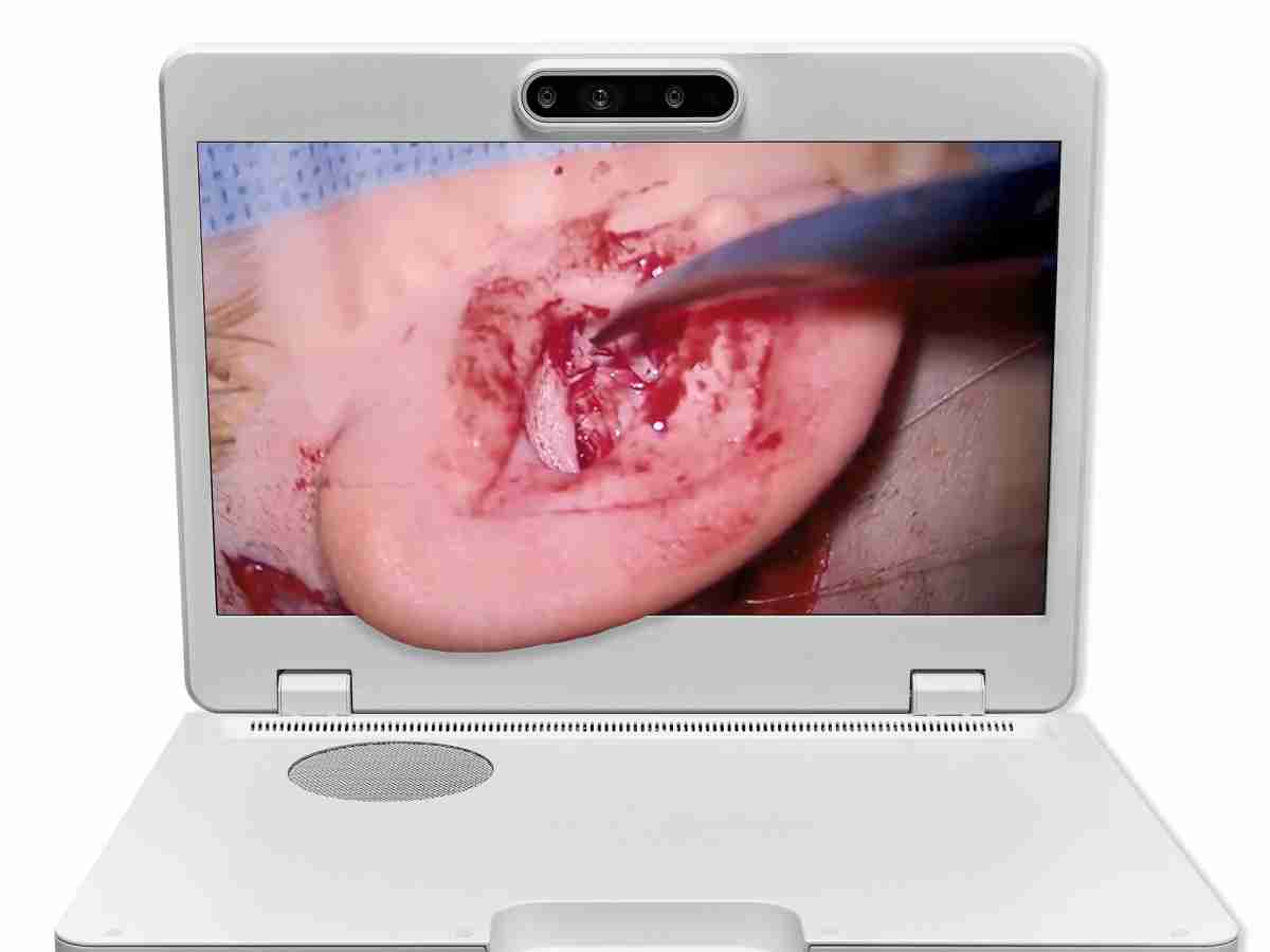 达擎之＂Heads-up 3D显微手术显示系统＂，，，整合4K裸眼3D显示及眼球追踪系统，，，，具备快速追踪人眼移动位置功能，，，，减轻医师长时间维持固定姿势的负担，，让医师能有更宽广清晰的3D立体视野及更舒适的姿势来执行手术。。。